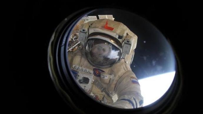 长期太空飞行后三成宇航员视觉系统变化，但不影响视觉敏锐度