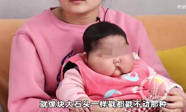 5月婴儿被曝使用抑菌霜后成“大头娃娃”，福建漳州卫健委：正在执法现场