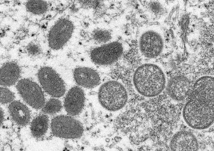 国家卫健委：自2023年9月20日起将猴痘纳入乙类传染病进行管理
