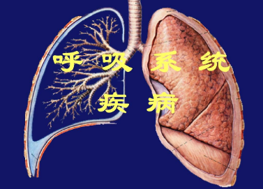 慢阻肺患者已达近亿人 我国亟待提高呼吸系统疾病防治水平