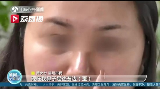 女子在苏州美莱美容医院隆鼻 术后却成歪鼻子