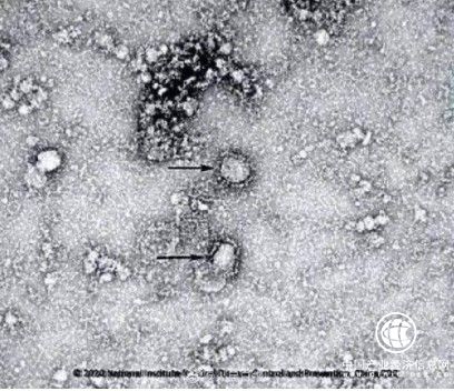 疫情防控：减少外出更要改善室内环境 