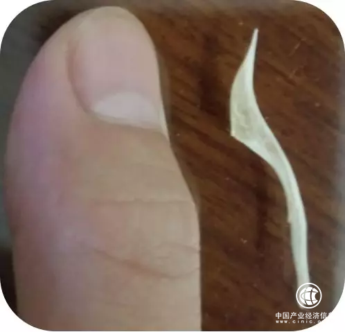 拂痛的妙手——难忘在山东医专附属医院耳鼻喉科的一次诊治