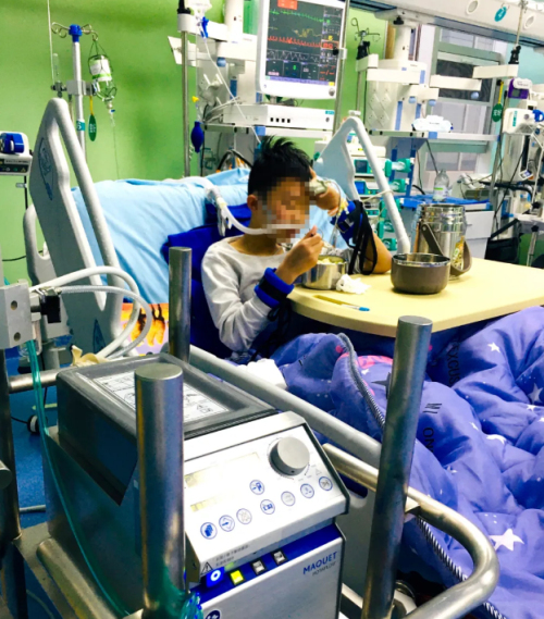 独自在家突患爆发性心肌炎 ecmo成功挽救12岁男孩生命