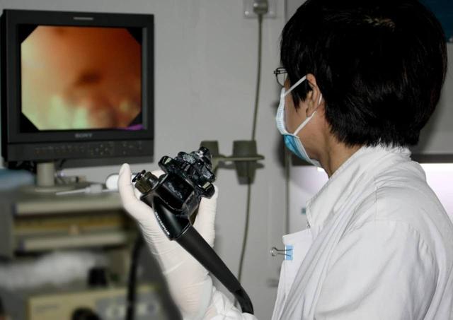 老人长期被胀气、反酸困扰纠缠德州联合医院脾胃科镜下扫除多枚“炸弹”