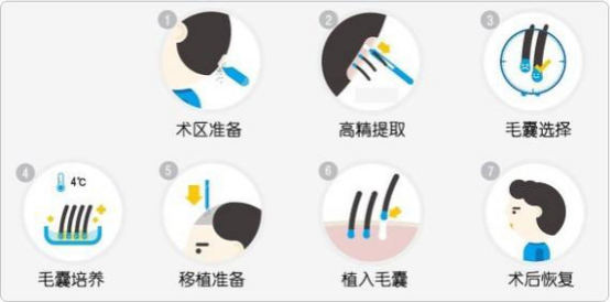 南通新生3D植发技术受国际赞誉 赴国外植发没有必要