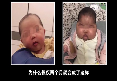 1200瓶“大头娃娃”涉事产品销往宿迁、连云港，两市正紧急排查！