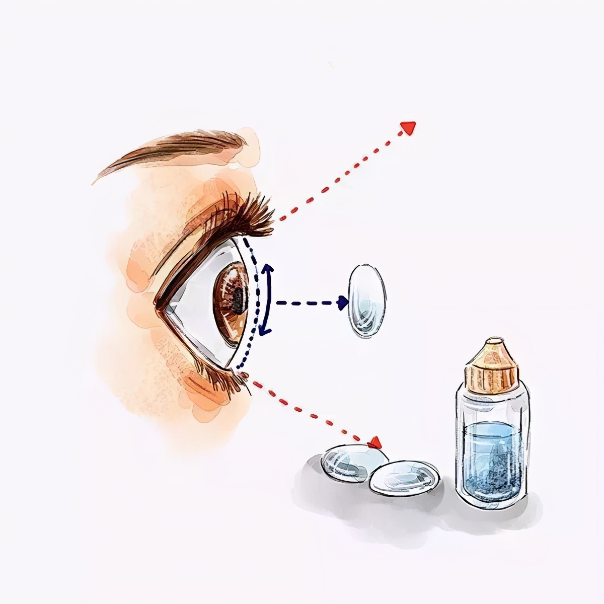 ok镜,轻松让孩子摘掉眼镜不再是梦