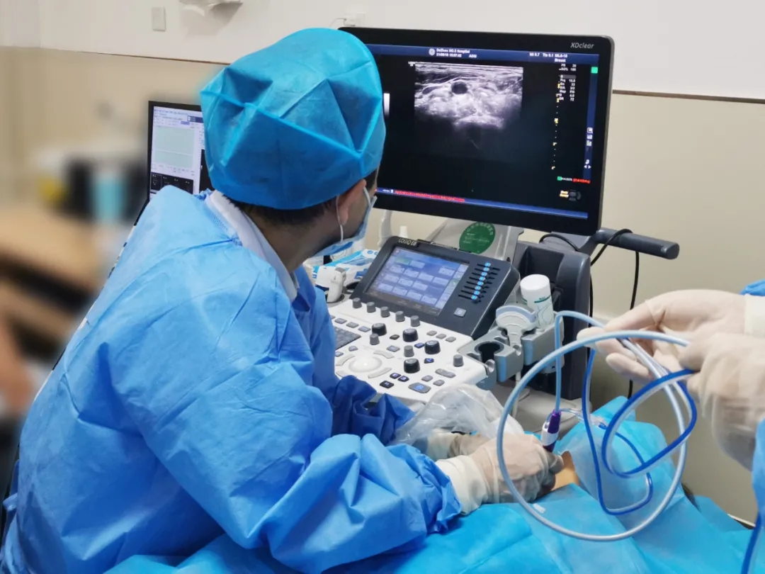 德州市第二人民医院:微波消融治疗甲状腺结节,微创无痕!