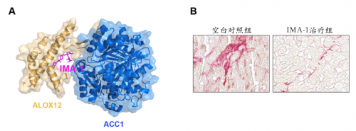  十年磨一剑 李红良教授团队研发非酒精性脂肪肝炎全新治疗药物