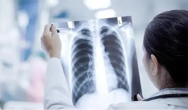 什么是“白肺”？如何避免新冠感染出现肺炎？——国家卫健委组织权威专家解答防疫热点问题