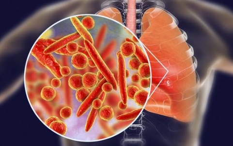 儿童肺炎支原体感染释疑