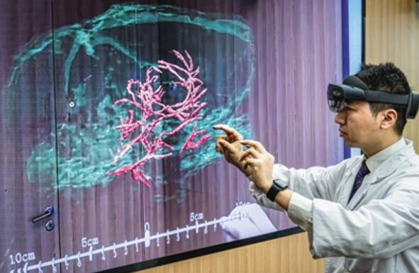 多因素催化 脑机接口产业发展迎跃迁